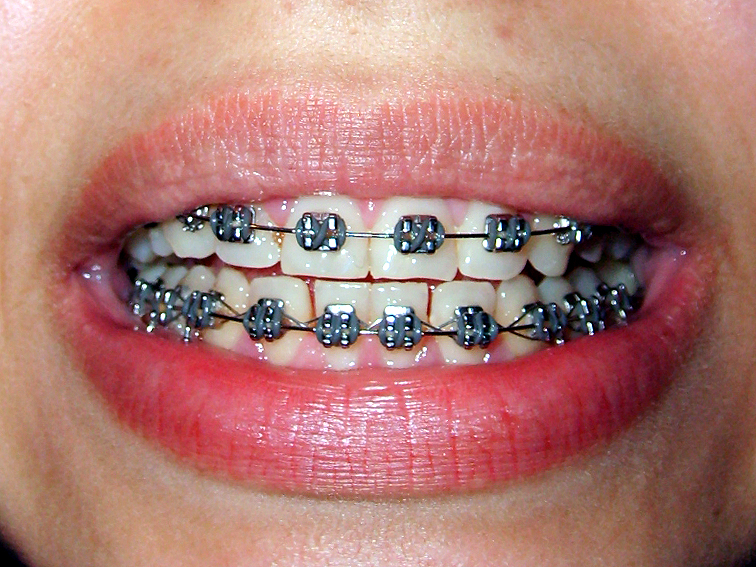 images/ortodonta.jpgd6a7a.jpg